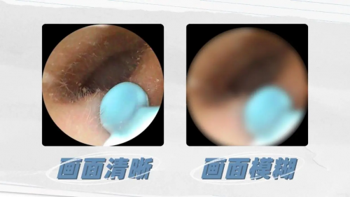 可视挖耳勺哪个品牌好？高清可视耳勺有哪几个牌子？可视内窥掏耳勺选购要点，挖耳勺最好的牌子是哪个？智能挖耳勺推荐