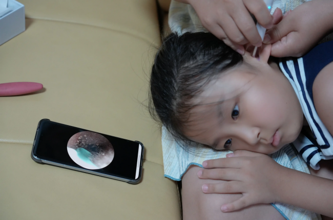 掏耳勺哪个品牌好？智能挖耳勺十大品牌有哪些？智能挖耳勺推荐