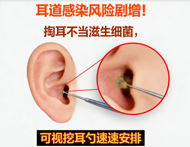 可视挖耳勺真的有用吗？可视挖耳勺品牌排行榜，这份清单直接码住