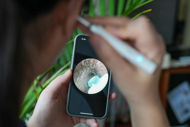 可视挖耳勺真的有用吗?可视耳勺方便吗?掏耳勺什么牌子好?2026可视挖耳勺十大排行榜,口碑好的可视耳勺推荐