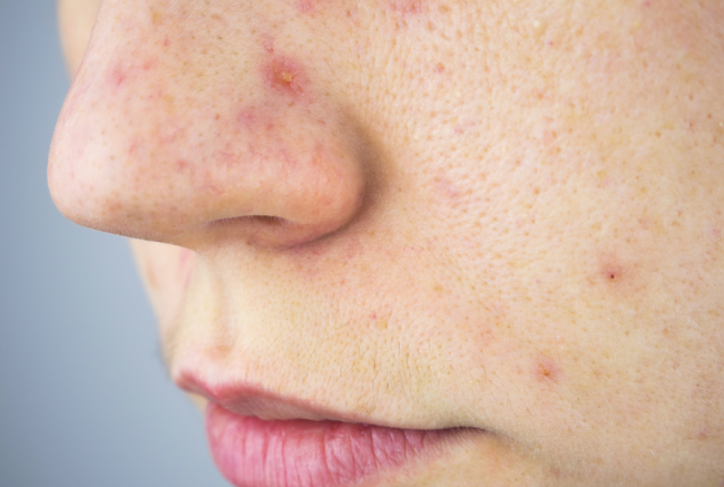 别让皮肤“假性饥饿”骗了你！艳存胶原水光，专治无效补水和虚浮紧致