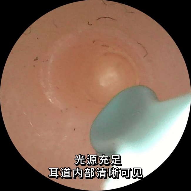 挖耳勺哪个品牌好？掏耳勺横评｜西圣vs蜂鸟可视挖耳勺实测推荐