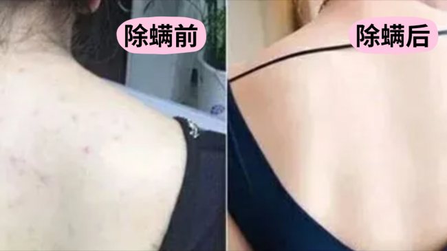 除螨仪哪个品牌最好最实用？床上如何除螨最有效的方法？智能除螨仪十大品牌，十大品牌除螨仪排名