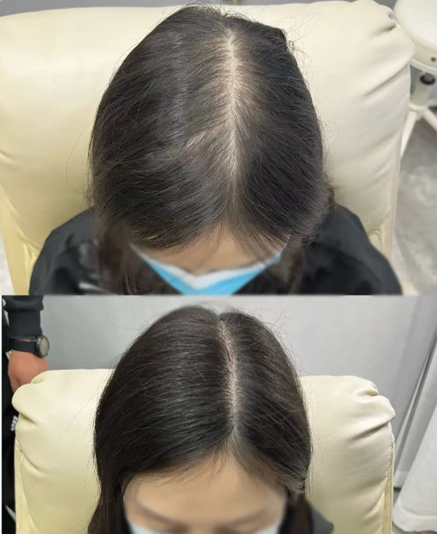 防脱生发最好的品牌有哪些?防脱精华液红黑榜TOP10对比 防脱生发最好的品牌有哪些?防脱精华液红黑榜TOP10对比