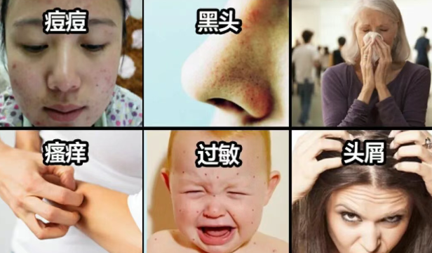 什么牌子的除螨仪家用性价比高?除螨仪家用床上哪个品牌好?权威测评出炉除螨仪十大品牌排行榜,闭眼入不踩雷