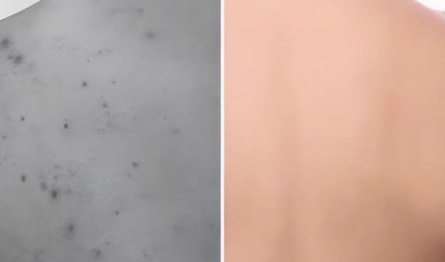 除螨仪家用床上哪个品牌好？除螨仪和吸尘器哪个实用？家用床上除螨仪十大排名，2026最新榜单