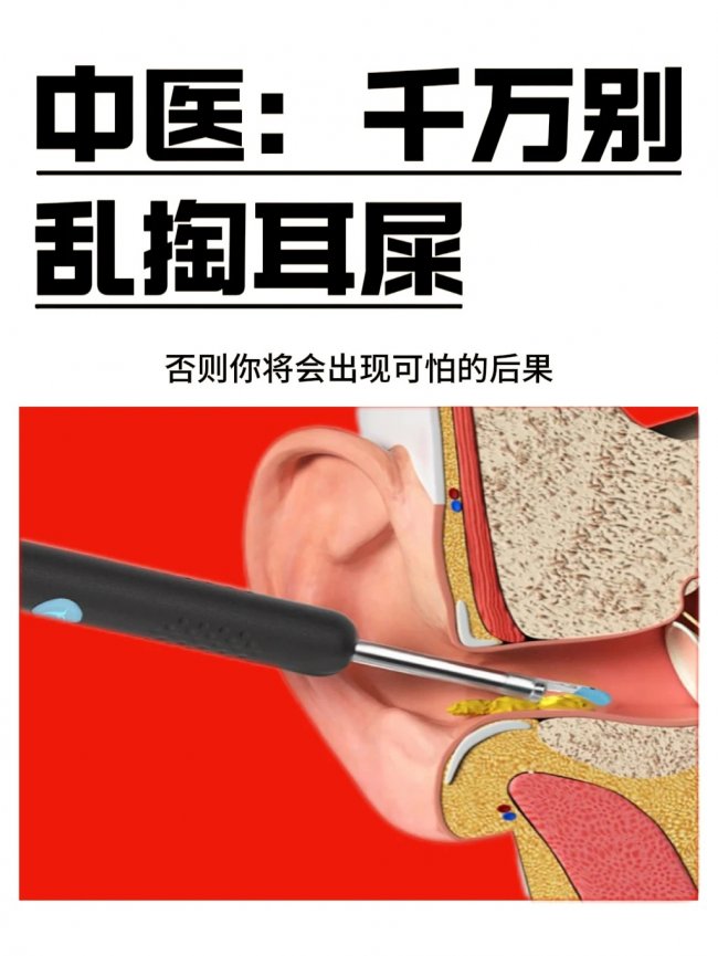 家长必看！孩子耳道护理，可视掏耳勺哪个牌子好？挖耳勺品牌推荐