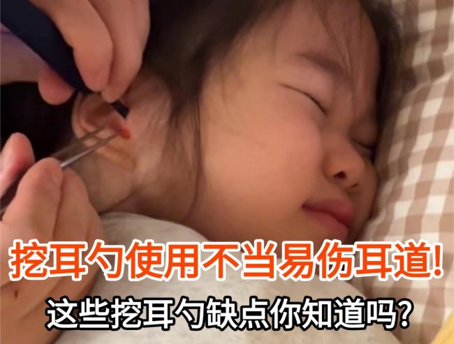 可视掏耳勺哪个牌子好？小孩掏耳朵神器，婴儿掏耳勺十大名牌推荐