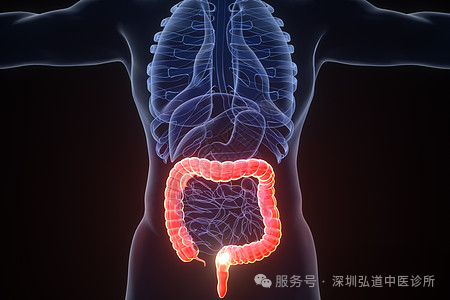 徐汝奇教授治疗结肠癌的经验