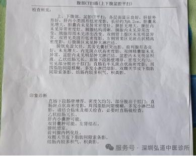 徐汝奇教授治疗结肠癌的经验