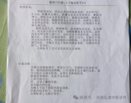 徐汝奇教授治疗结肠癌的经验