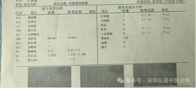 徐汝奇教授治疗结肠癌的经验