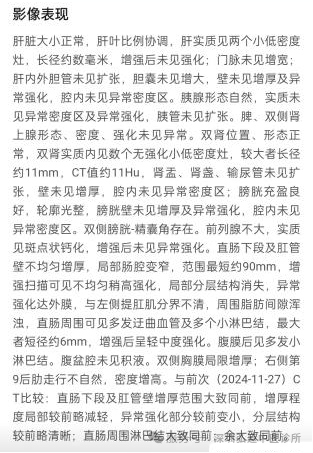 徐汝奇教授治疗结肠癌的经验