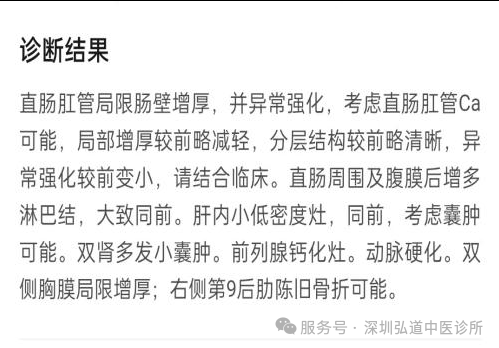 徐汝奇教授治疗结肠癌的经验