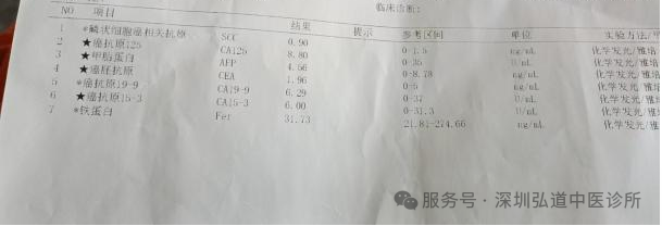 徐汝奇教授治疗结肠癌的经验