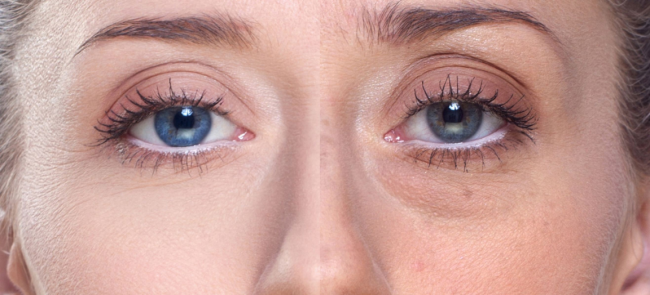 艳存晓年轻胶原水光套组：胶原支架+玻尿酸水库，初老直接破防！