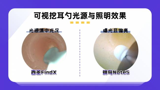 200元可视挖耳勺实测：可视挖耳勺哪个品牌好？西圣vs蜂鸟博主亲测