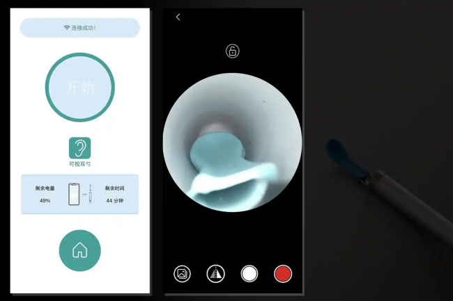 2026可视耳勺哪个牌子好？掏耳勺什么牌子的好？挖耳勺推荐必看！