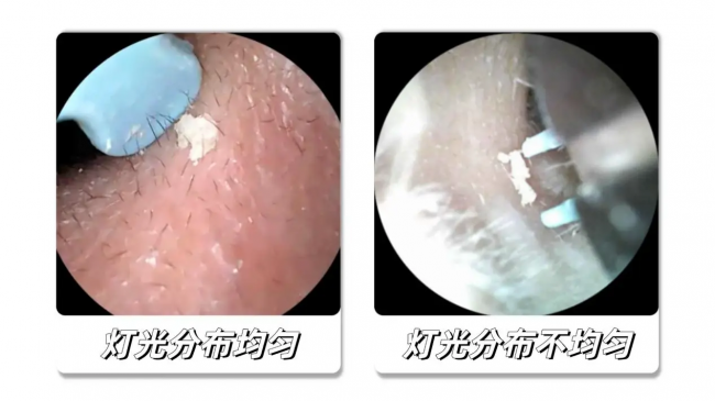 哪种挖耳勺最好用？可视挖耳勺哪款好？2026挖耳勺最好的牌子推荐