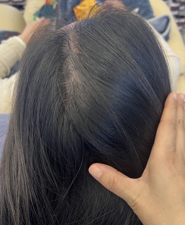 脱发救星！草木契约