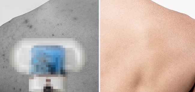 床上除螨神器哪个品牌好?床上螨虫怎么除最彻底?除螨仪排行榜前十名性价比分享,2026 实测不踩坑