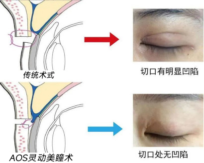 想做妈生眼先看这场会 AOS灵动美瞳术成培训会最大亮点