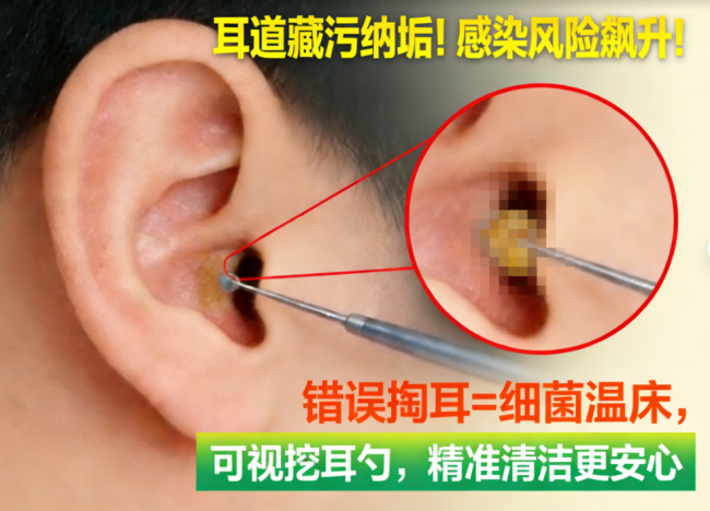 哪种挖耳勺好用不伤耳?螺旋式挖耳勺好用吗?可视挖耳勺掏耳推荐