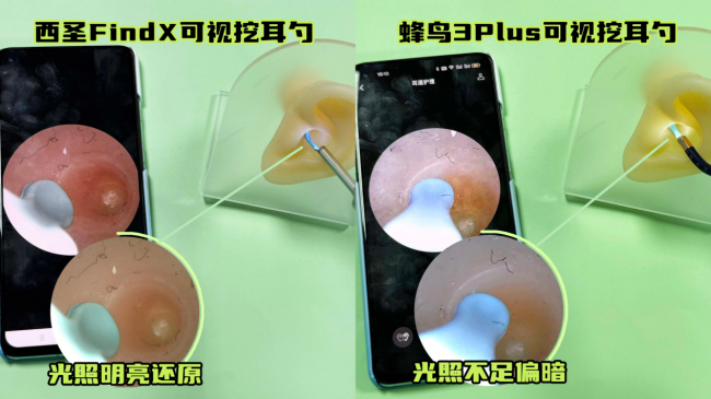 可视掏耳勺哪个牌子好？西圣蜂鸟可视挖耳勺实测对比，家用精准入