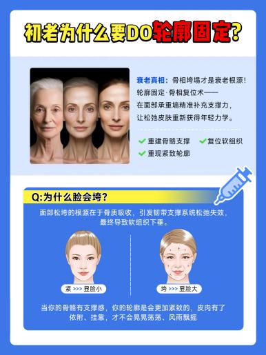 脸垮、脸宽怎么办？“结构性衰老”该考虑筱缇玻尿酸了