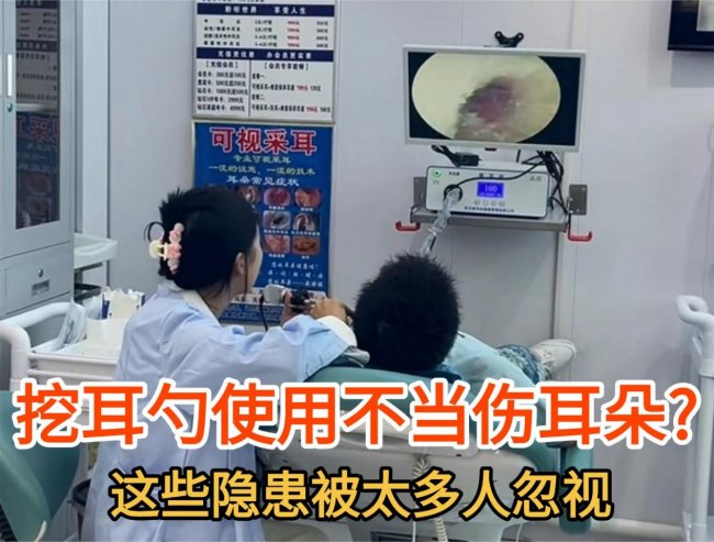 智能挖耳勺好用吗?2026年智能挖耳勺推荐,挖耳勺最好的牌子大全