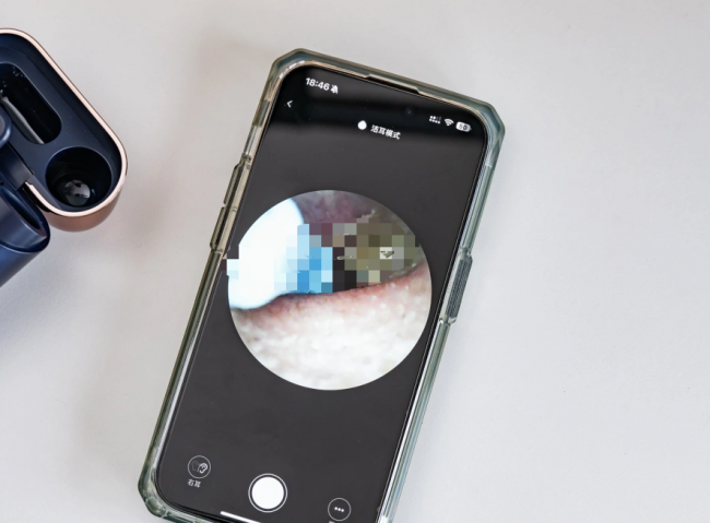 可视挖耳勺是智商税吗？可视掏耳勺好不好？掏耳勺哪种好？2026可视挖耳勺选购指南