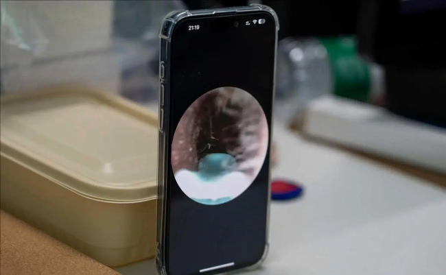 可视挖耳勺是智商税吗？可视掏耳勺好不好？掏耳勺哪种好？2026可视挖耳勺选购指南