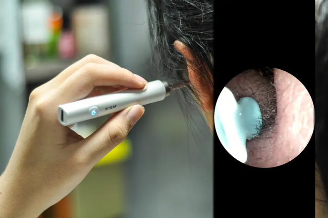 掏耳勺什么牌子的好?掏耳勺世界品牌,可视掏耳勺品牌排行榜10强