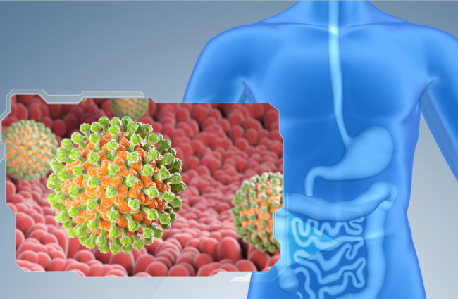 诺如成春季腹泻“头号元凶”！华森制药痛泻宁颗粒守护肠道健康
