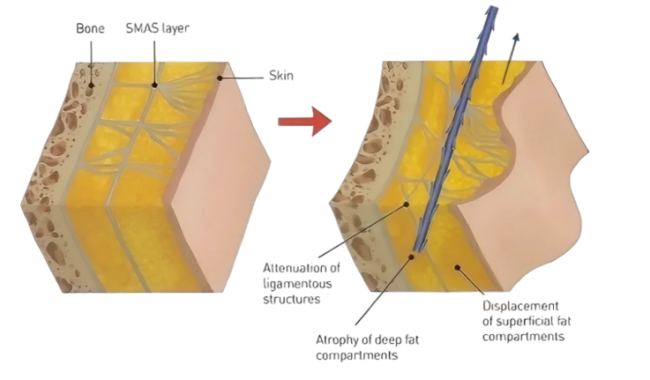 MINT®秘特领跑:从价格战突围,向价值战进化 MINT®秘特领跑:从价格战突围,向价值战进化