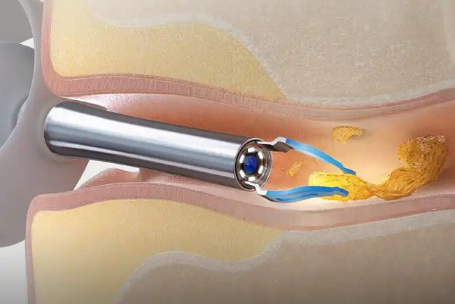 可视掏耳勺什么牌子好？可视掏耳勺推荐品牌有哪些？长文解读精选