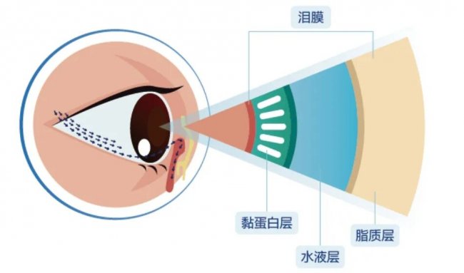 中卫爱尔眼科医院提醒：长期眼干、眼酸、怕光？可能是“干眼症”发出的预警信号