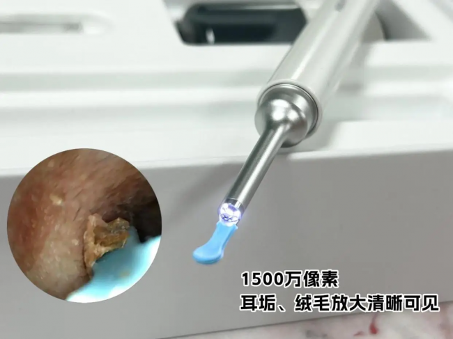 可视掏耳朵设备有哪些品牌？可视掏耳朵哪个品牌好？可视掏耳勺推荐