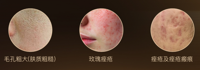 半岛逆时针真相科普：皮肤会变薄？发数越多效果越好？