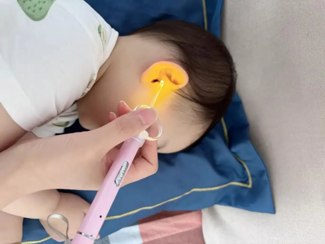 怎么给小孩掏耳屎？儿童掏耳朵用什么工具？可视掏耳勺名牌推荐