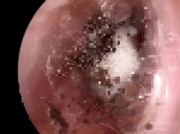 智能挖耳勺哪个牌子好？爆品十大好用的无线可视挖耳勺推荐