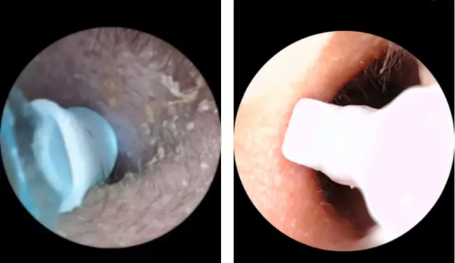 可视掏耳勺哪个牌子好？掏耳勺品牌排行榜前十，采耳工具十大排名