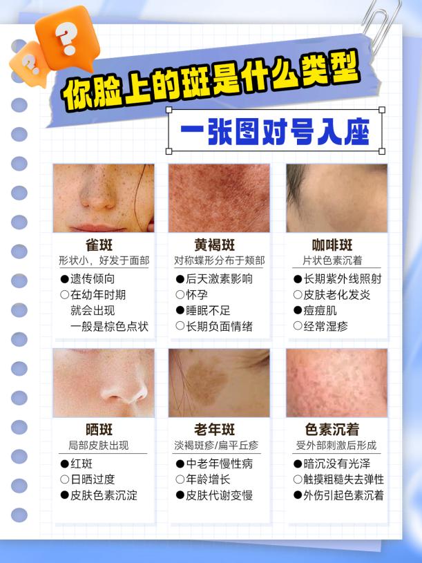 脸上的斑怎么去除最有效?|皮肤科专家许丽英教你科学避坑 脸上的斑怎么去除最有效?|皮肤科专家许丽英教你科学避坑
