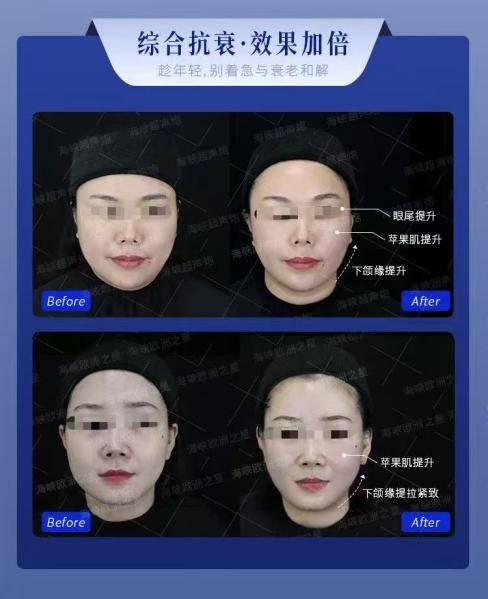 林志颖VS郭德纲:同龄不同脸的抗衰真相,殷彩译主任一语道破 林志颖VS郭德纲:同龄不同脸的抗衰真相,殷彩译主任一语道破