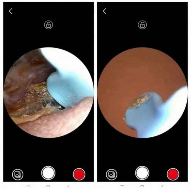 可视掏耳勺好用吗？弹簧挖耳勺好用吗？可视掏耳勺热销品牌排行