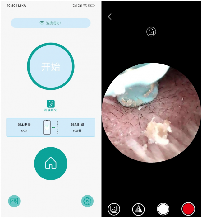 儿童怎么掏耳朵？怎么给小孩掏耳屎？儿童掏耳朵神器推荐2026
