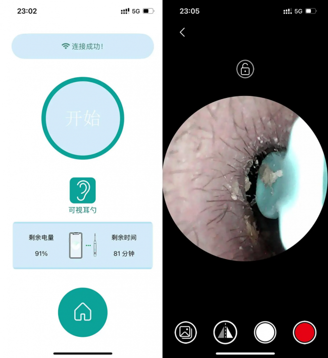 掏耳神器可以挖耳朵吗？掏耳朵工具哪个品牌好？掏耳朵的专用工具