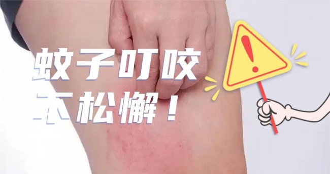 房间灭蚊灯哪个牌子好用？十大旗舰房间灭蚊灯品牌推荐！希亦/美的等十款实力在线的灭蚊灯品牌盘点
