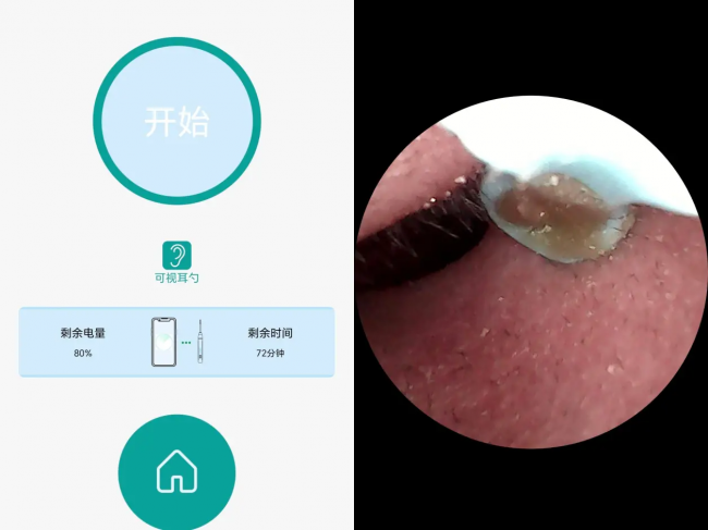 可视采耳器哪个牌子好？掏耳勺买哪个最好？可视采耳10大忠告必看