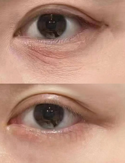 露卡菲娅小蓝瓶淡纹眼霜：口碑出圈破圈成长，国货淡纹新势力崛起正当时